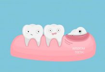 What to expect when getting your wisdom tooth removed? wisdom tooth
