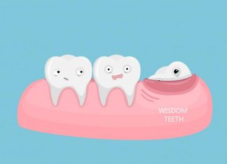 What to expect when getting your wisdom tooth removed? wisdom tooth